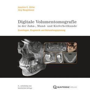 Digitale Volumentomografie in der Zahn-, Mund- und Kieferheilkunde von Neugebauer,  Jörg, Zöller,  Joachim E.