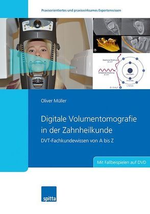 Digitale Volumentomografie in der Zahnheilkunde von Müller,  Oliver