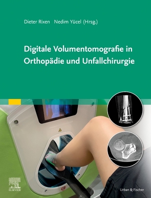 Digitale Volumentomografie in Orthopädie und Unfallchirurgie von Rixen,  Dieter, Yücel,  Nedim