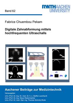 Digitale Zahnabformung mittels hochfrequenten Ultraschalls von Chuembou Pekam,  Fabrice