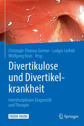 Divertikulose und Divertikelkrankheit von Germer,  Christoph-Thomas, Kruis,  Wolfgang, Leifeld,  Ludger