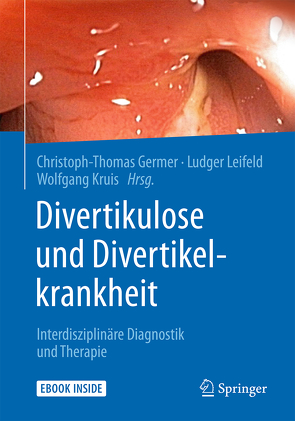 Divertikulose und Divertikelkrankheit von Germer,  Christoph-Thomas, Kruis,  Wolfgang, Leifeld,  Ludger