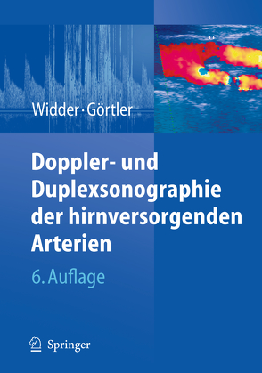 Doppler- und Duplexsonographie der hirnversorgenden Arterien von Görtler,  Michael, Widder,  Bernhard