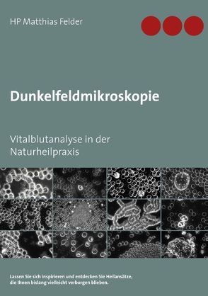 Dunkelfeldmikroskopie von Felder,  Matthias