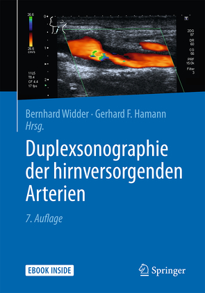 Duplexsonographie der hirnversorgenden Arterien von Hamann,  Gerhard, Widder,  Bernhard