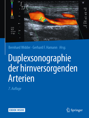 Duplexsonographie der hirnversorgenden Arterien von Hamann,  Gerhard, Widder,  Bernhard