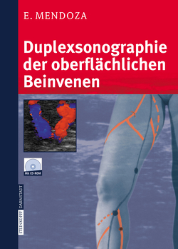 Duplexsonographie der oberflächlichen Beinvenen von Mendoza,  Erika