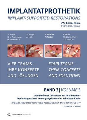 DVD-Kompendium Implantatprothetik Band 3 von Weber,  Volker, Wolfart,  Stefan