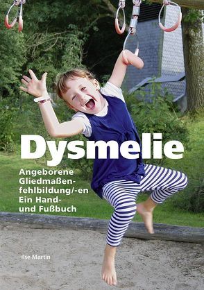 Dysmelie Angeborene Gliedmaßenfehlbildung/-en von Brugger,  Peter, Martin,  Ilse