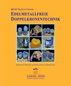 Edelmetallfreie Doppelkronentechnik von Wulfes,  Henning