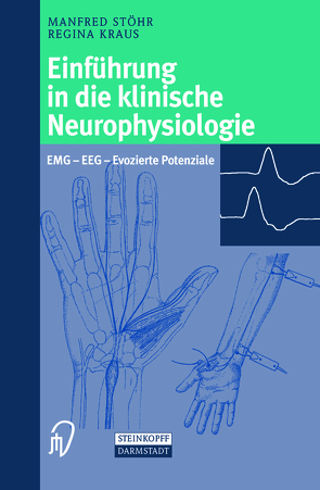 Einführung in die klinische Neurophysiologie von Kraus,  Regina, Pfister,  Robert, Scheglmann,  Konrad, Stöhr,  Manfred