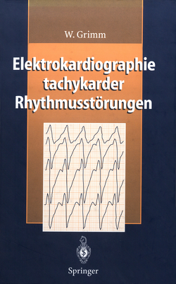 Elektrokardiographie tachykarder Rhythmusstörungen von Grimm,  W., Maisch,  B.
