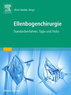 Ellenbogenchirurgie von Stöckle,  Ulrich