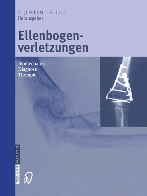 Ellenbogenverletzungen von Josten,  C., Lill,  H.