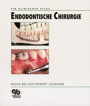 Endodontische Chirurgie von Bakland,  L K, Bellizzi,  Ralph, Hartwell,  G R, Hoefer,  Georg, Loushine,  Robert