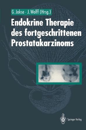 Endokrine Therapie des fortgeschrittenen Prostatakarzinoms von Jakse,  Gerhard, Wolff,  Johannes
