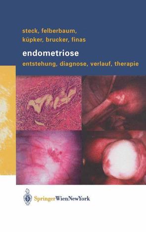 Endometriose von Brucker,  Cosima, Felberbaum,  Ricardo E., Finas,  Dominique F., Küpker,  Wolfgang, Steck,  Thomas
