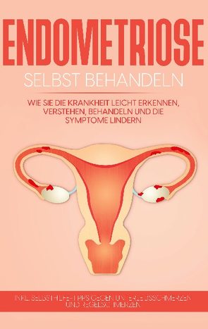 Endometriose selbst behandeln: Wie Sie die Krankheit leicht erkennen, verstehen, behandeln und die Symptome lindern – inkl. Selbsthilfe-Tipps gegen Unterleibsschmerzen und Regelschmerzen von Engelhardt,  Anita