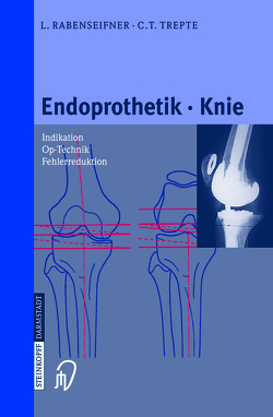Endoprothetik Knie von Rabenseifner,  L., Trepte,  C.