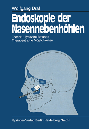 Endoskopie der Nasennebenhöhlen von Draf,  Wolfgang, Kley,  Walter