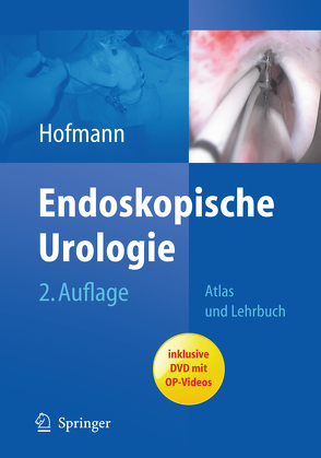 Endoskopische Urologie von Hofmann,  Rainer