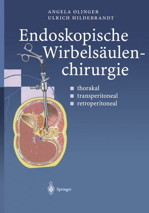Endoskopische Wirbelsäulenchirurgie von Hildebrandt,  Ulrich, Menger,  M.D., Olinger,  Angela, Vollmar,  B.