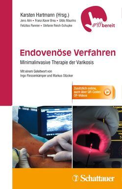 Endovenöse Verfahren von Alm,  Jens, Breu,  Franz-Xaver, Hartmann,  Karsten, Maurins,  Uldis, Pannier,  Felizitas