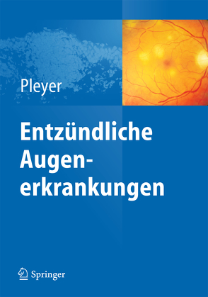 Entzündliche Augenerkrankungen von Pleyer,  Uwe