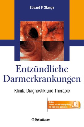 Entzündliche Darmerkrankungen von Stange,  Eduard F.