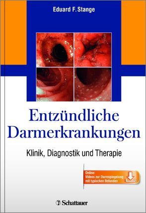 Entzündliche Darmerkrankungen von Stange,  Eduard F.