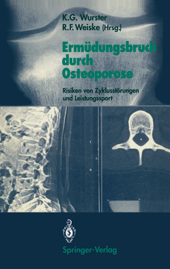 Ermüdungsbruch durch Osteoporose von Weiske,  Roman F., Wurster,  Kurt G.