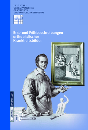 Erst- und Frühbeschreibungen orthopädischer Krankheitsbilder von Rauschmann,  Michael A., Thomann,  Klaus-Dieter, Zichner,  Ludwig