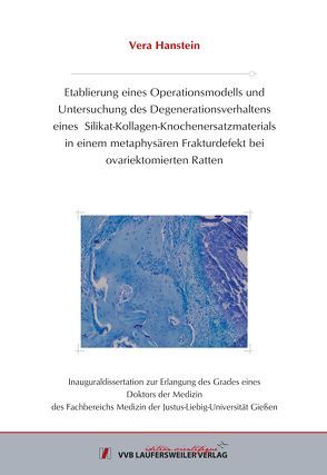 Etablierung eines Operationsmodells und Untersuchung des Degenerationsverhaltens eines Silikat-Kollagen-Knochenersatzmaterials in einem metaphysären Frakturdefekt bei ovariektomierten Ratten von Hanstein ,  Vera