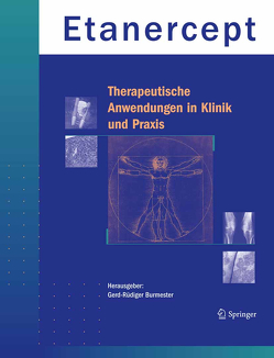Etanercept – Therapeutische Anwendungen in Klinik und Praxis von Burmester,  Gerd-Rüdiger