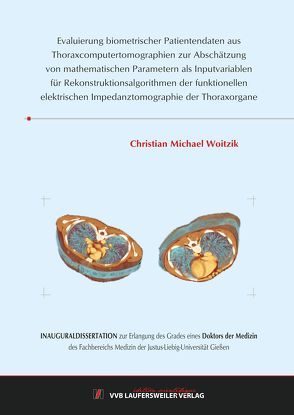 Evaluierung biometrischer Patientendaten aus Thoraxcomputertomographien zur Abschätzung von mathematischen Parametern als Inputvariablen für Rekonstruktionsalgorithmen der funktionellen elektrischen Impedanztomographie der Thoraxorgane von Woitzik,  Christian Michael