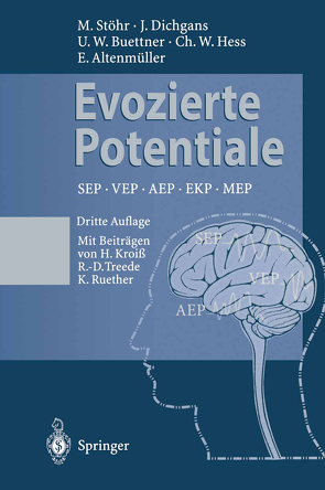 Evozierte Potentiale von Altenmüller,  E., Buettner,  Ulrich W., Dichgans,  J., Hess,  C.W., Kroiss,  H., Ruether,  K., Stöhr,  Manfred, Treede,  R.-D.