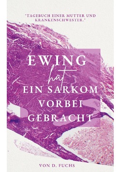 Ewing hat ein Sarkom vorbeigebracht von Fuchs,  D