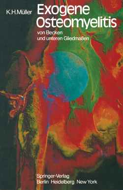 Exogene Osteomyelitis von Becken und unteren Gliedmaßen von Müller,  K.-H., Rehn,  J.