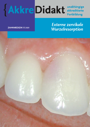 Externe zervikale Wurzelresorption von Mavridou,  Athina, Warnsinck,  Jan