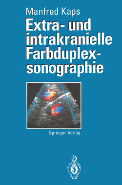 Extra- und intrakranielle Farbduplexsonographie von Kaps,  M., Seidel,  G.