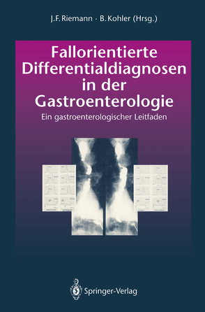 Fallorientierte Differentialdiagnosen in der Gastroenterologie von Demling,  L., Kohler,  B, Riemann,  J.F.