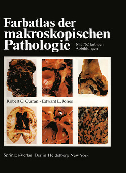 Farbatlas der makroskopischen Pathologie von Bürki,  K., Cottier,  H., Curran,  R.C., Jones,  E. L., Roos,  B., Zimmermann,  A