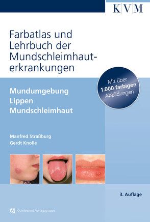 Farbatlas und Lehrbuch der Mundschleimhauterkrankungen von Knolle,  Gerdt, Strassburg,  Manfred