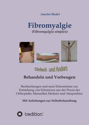 Fibromyalgie (Fibromyalgia simplex) einfach und anders behandeln und vorbeugen von Dr.Dr. Model,  Anselm