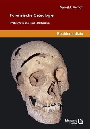 Forensische Osteologie von Verhoff,  Marcel A.
