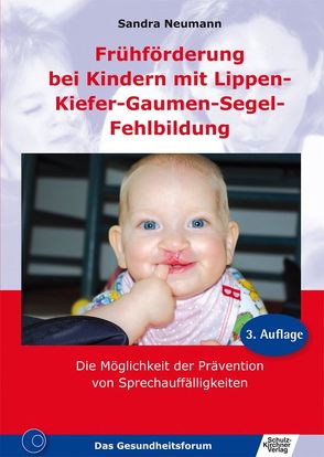 Frühförderung bei Kindern mit Lippen-Kiefer-Gaumen-Segel-Fehlbildung von Neumann,  Sandra