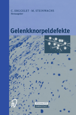 Gelenkknorpeldefekte von Erggelet,  C., Steinwachs,  M.