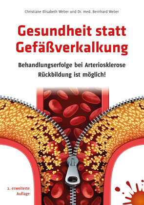 Gesundheit statt Gefäßverkalkung von Weber,  Christiane E., Weber,  Dr. med. Bernhard