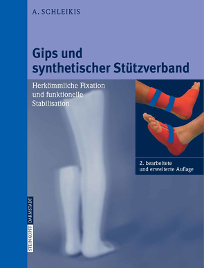 Gips und synthetischer Stützverband von Schleikis,  A., Stürmer,  K.-M.