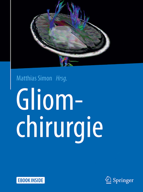 Gliomchirurgie von Simon,  Matthias